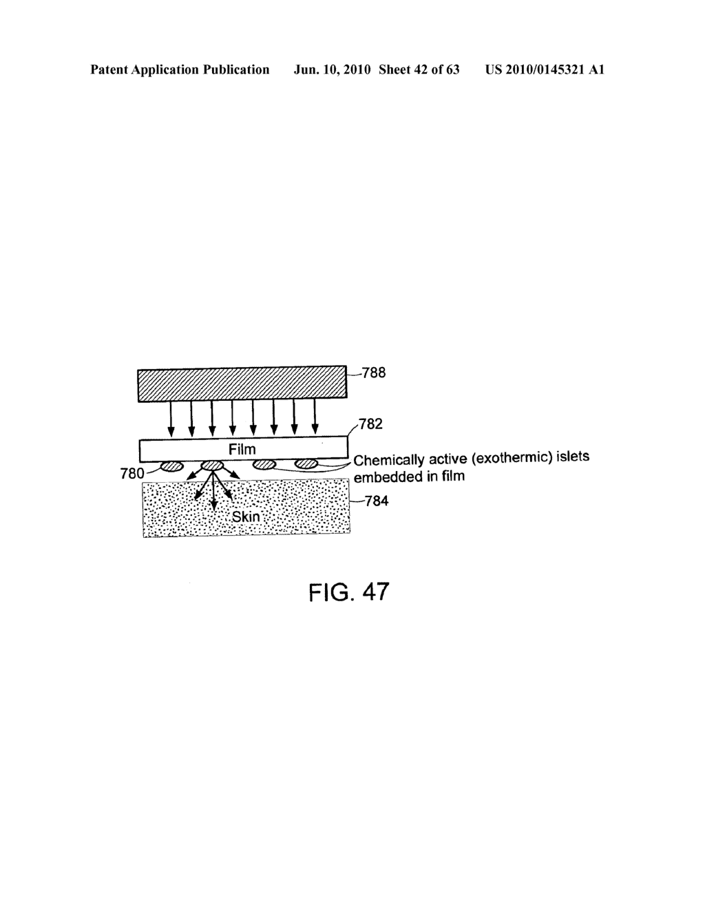 METHODS AND PRODUCTS FOR PRODUCING LATTICES OF EMR-TREATED ISLETS IN TISSUES, AND USES THEREFOR - diagram, schematic, and image 43