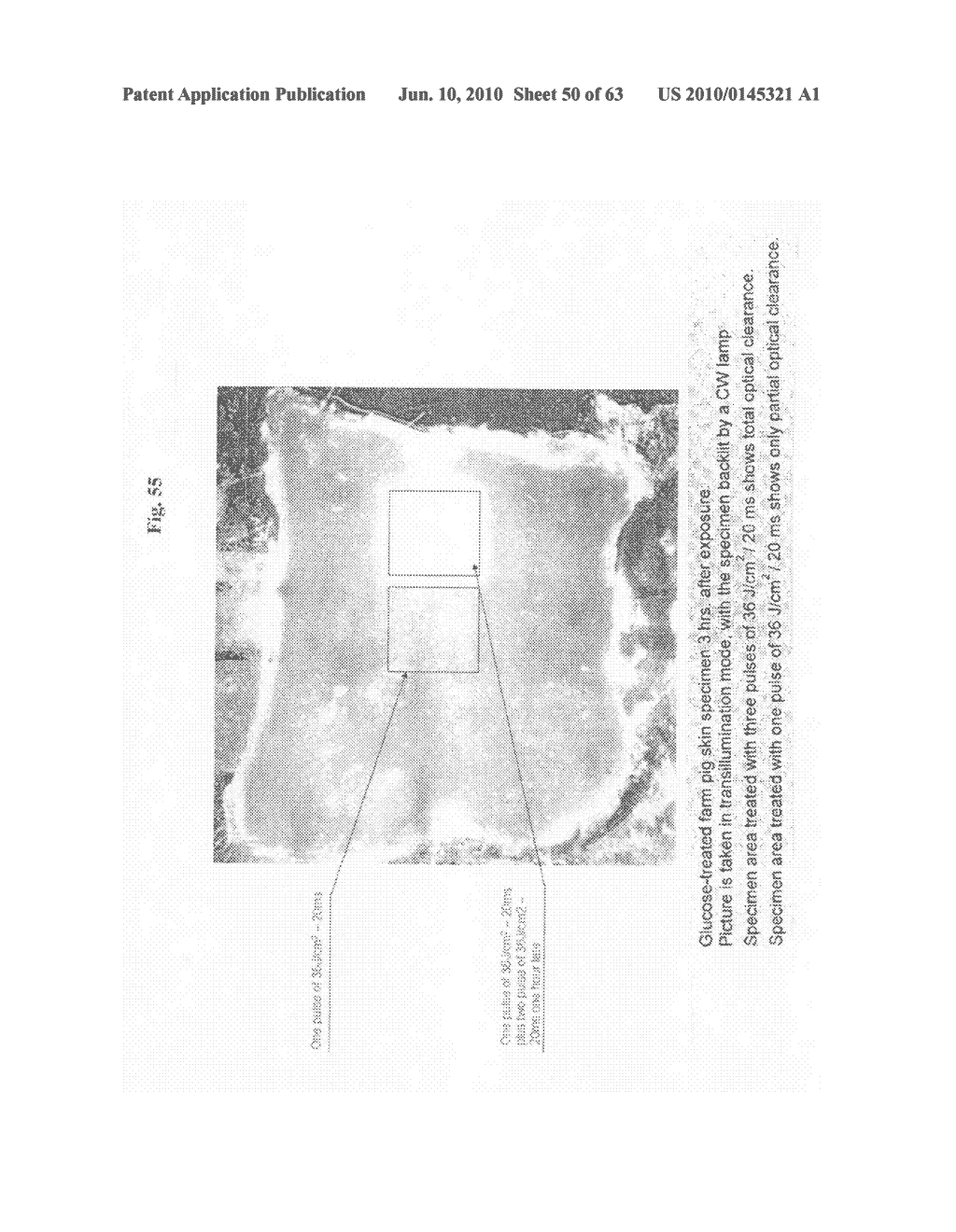 METHODS AND PRODUCTS FOR PRODUCING LATTICES OF EMR-TREATED ISLETS IN TISSUES, AND USES THEREFOR - diagram, schematic, and image 51