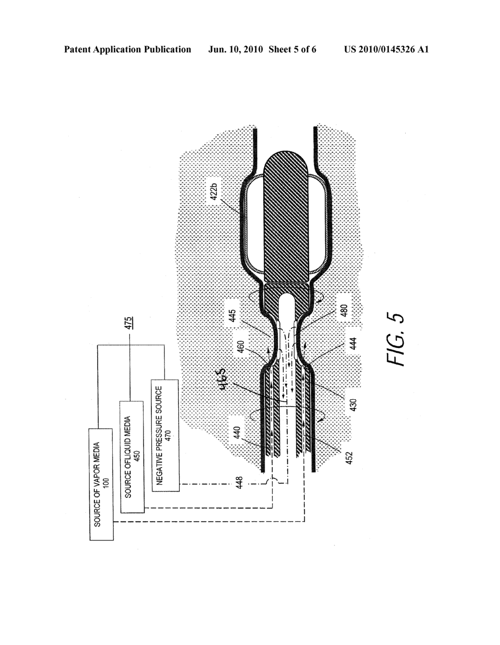 Systems and Methods for Treatment of BPH - diagram, schematic, and image 06