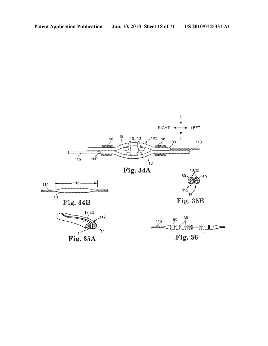 Loop Ablation Apparatus and Method - diagram, schematic, and image 19