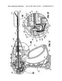 Vessel Sealer and Divider diagram and image