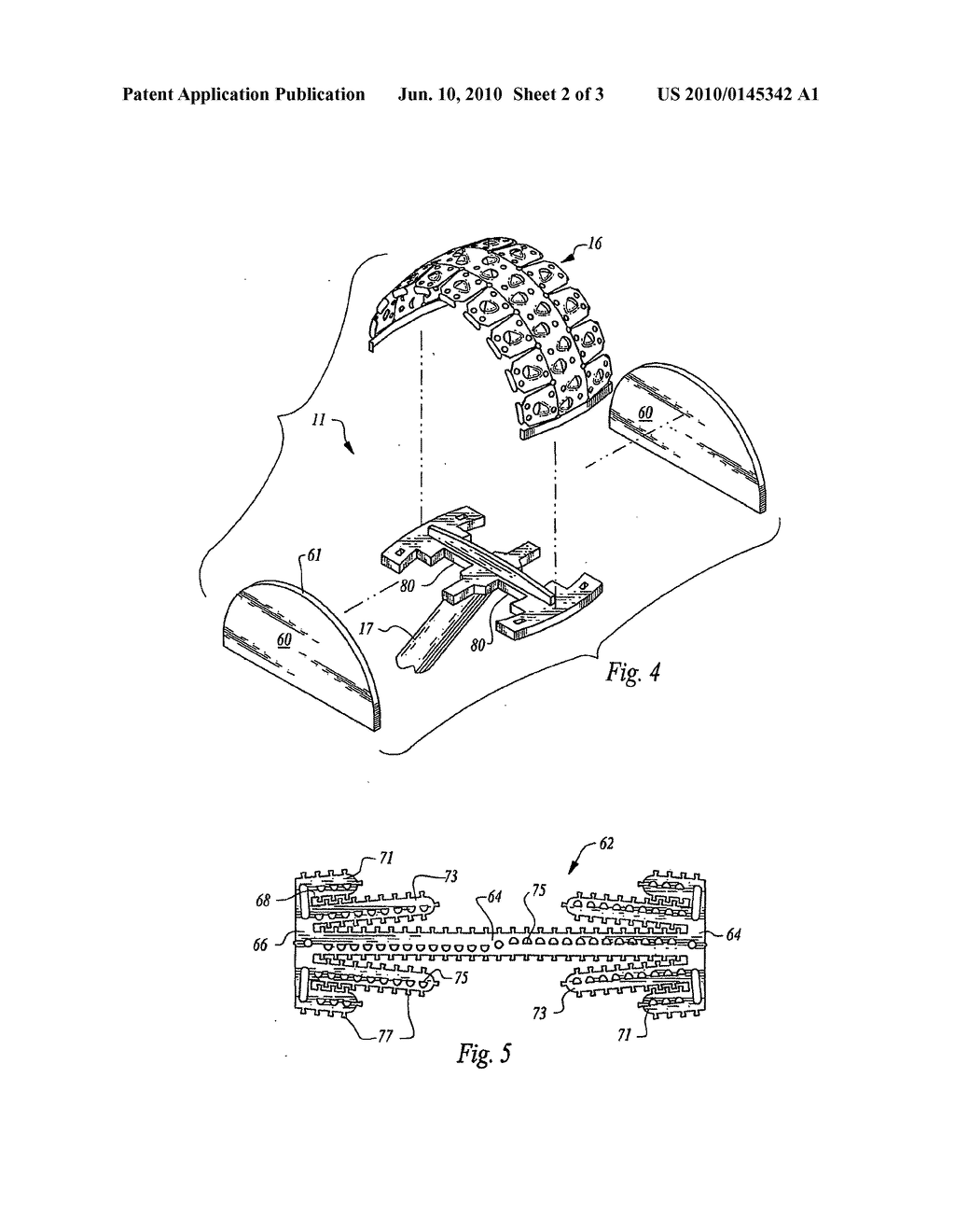 DISPOSABLE ACETABULAR REAMER AND METHOD OF FABRICATING THE SAME - diagram, schematic, and image 03
