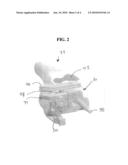 METHOD AND SYSTEM FOR COMPUTER ASSISTED SURGERY FOR BICOMPARTMENTAL KNEE REPLACEMENT diagram and image