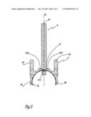 CENTERING JIG FOR RESURFACING THE HEAD OF THE FEMUR AND METHOD diagram and image