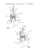 CENTERING JIG FOR RESURFACING THE HEAD OF THE FEMUR AND METHOD diagram and image