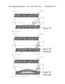 HOOD METHOD AND DEVICE FOR ENDOSCOPIC SUBMUCOSAL DISSECTION diagram and image