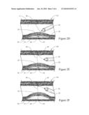 HOOD METHOD AND DEVICE FOR ENDOSCOPIC SUBMUCOSAL DISSECTION diagram and image