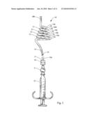 Irrigating Catch and Removal Device diagram and image