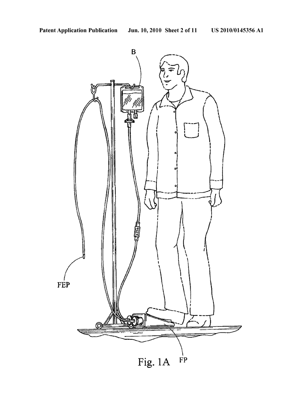 Irrigating Catch and Removal Device - diagram, schematic, and image 03