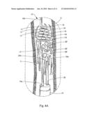 Irrigating Catch and Removal Device diagram and image