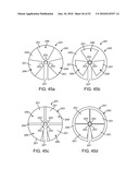 BURR HOLE PLUG HAVING DUAL SLIDABLE CLAMPING MECHANISMS diagram and image