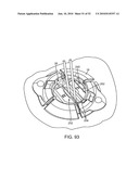 BURR HOLE PLUG HAVING DUAL SLIDABLE CLAMPING MECHANISMS diagram and image