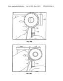 SYSTEM AND METHOD FOR TRANSPLANTATION OF DERMAL TISSUE diagram and image