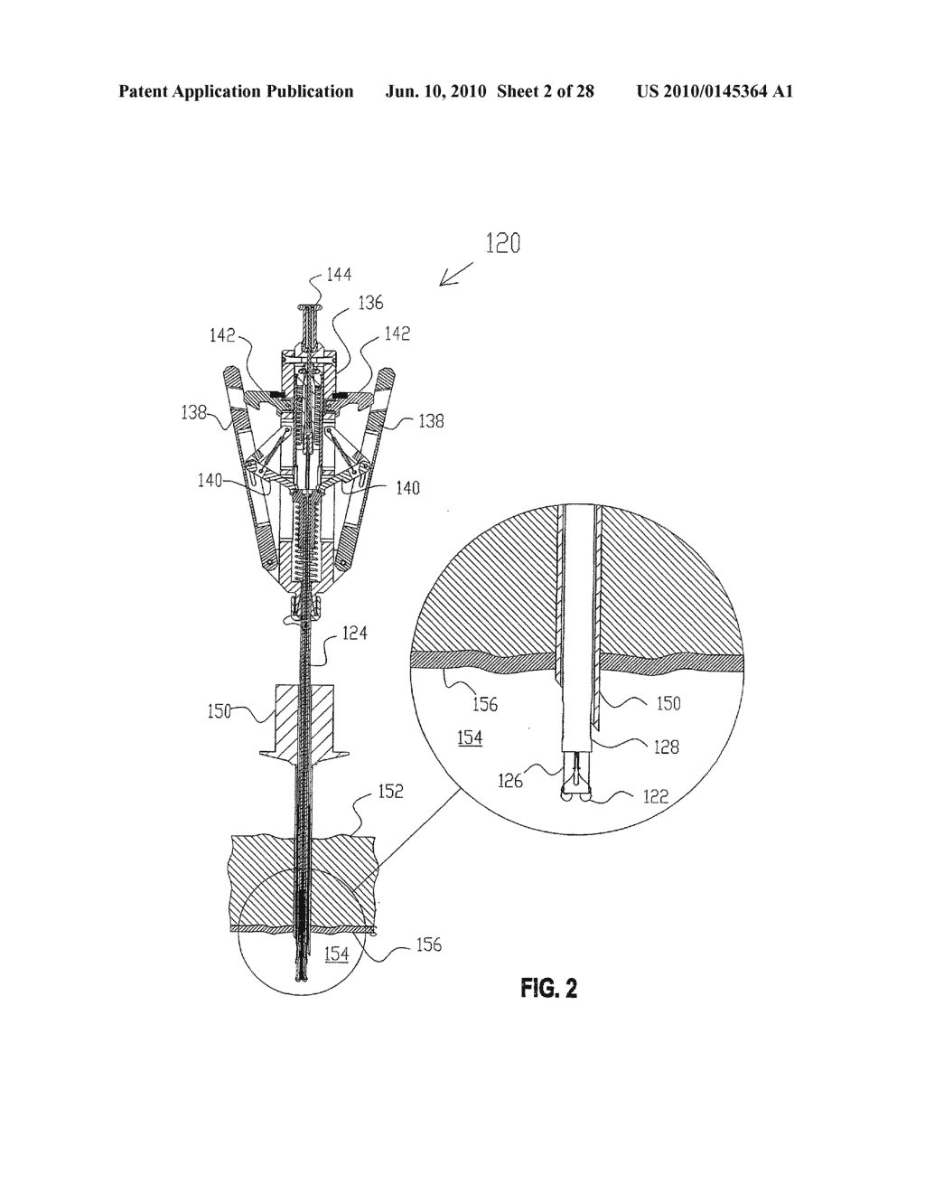 Suture Device - diagram, schematic, and image 03