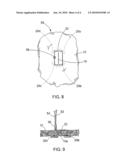 TISSUE ANCHORS FOR PURSE-STRING CLOSURE OF PERFORATIONS diagram and image