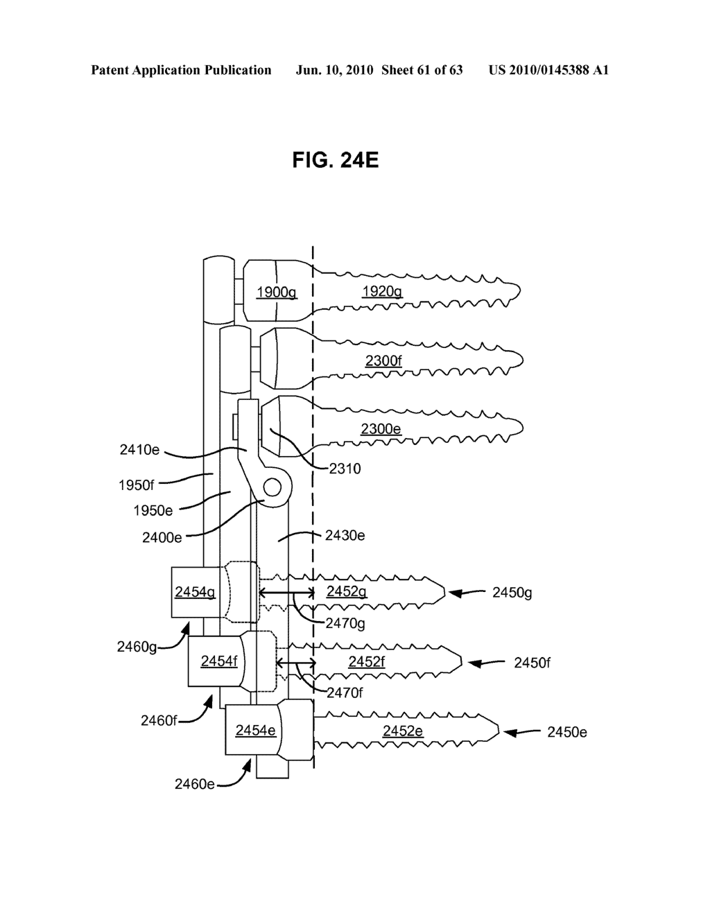 LOW PROFILE SPINAL PROSTHESIS INCORPORATING A BONE ANCHOR HAVING A DEFLECTABLE POST AND A COMPOUND SPINAL ROD - diagram, schematic, and image 62