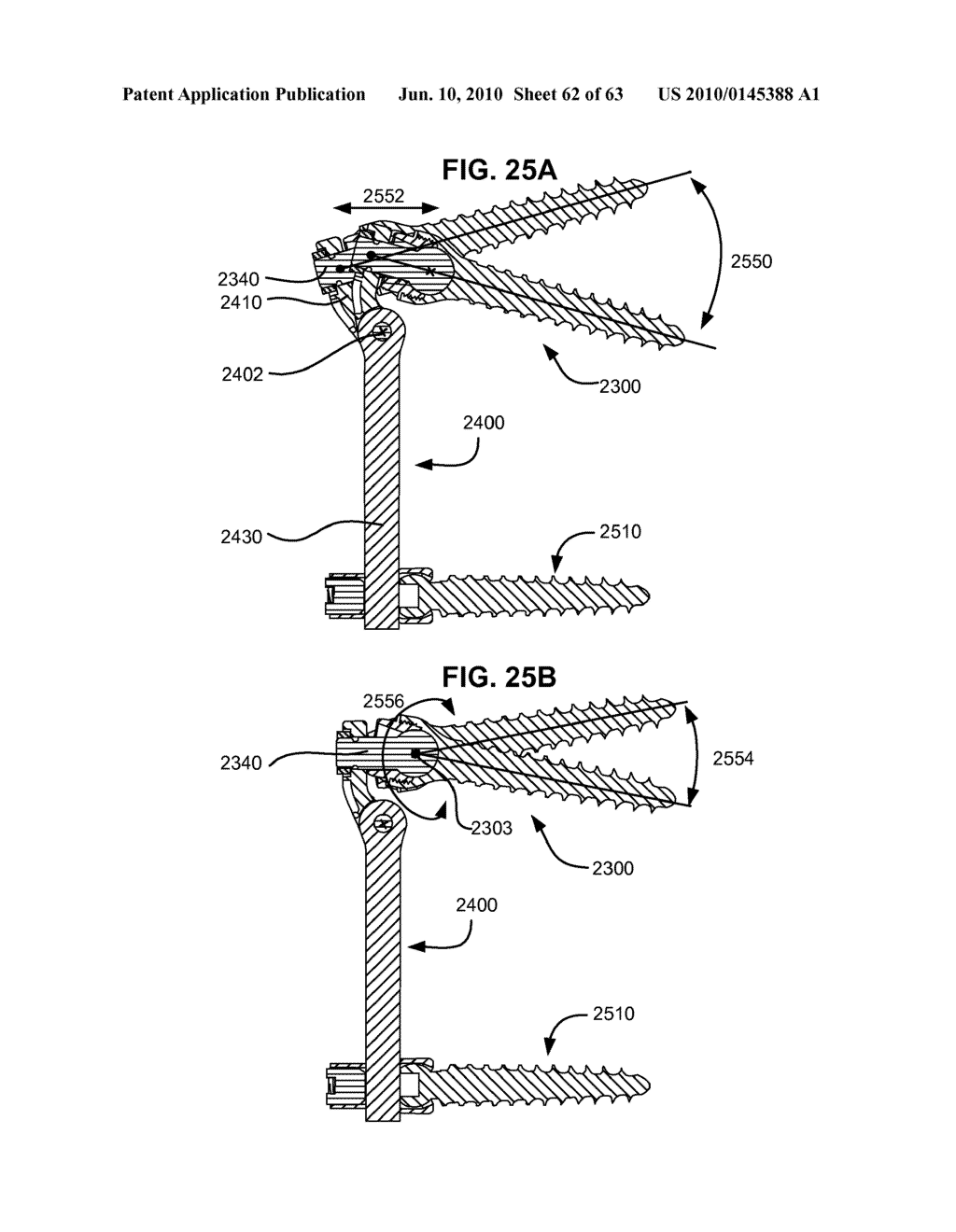 LOW PROFILE SPINAL PROSTHESIS INCORPORATING A BONE ANCHOR HAVING A DEFLECTABLE POST AND A COMPOUND SPINAL ROD - diagram, schematic, and image 63