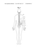 MEDICAL DEVICE ELECTRICAL LEAD DESIGN FOR PREVENTING TRANSMITTANCE OF UNSAFE CURRENTS TO A PATIENT diagram and image