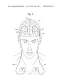 MEDICAL DEVICE ELECTRICAL LEAD DESIGN FOR PREVENTING TRANSMITTANCE OF UNSAFE CURRENTS TO A PATIENT diagram and image