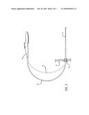 DELIVERY SYSTEM FOR MEDICAL DEVICES diagram and image