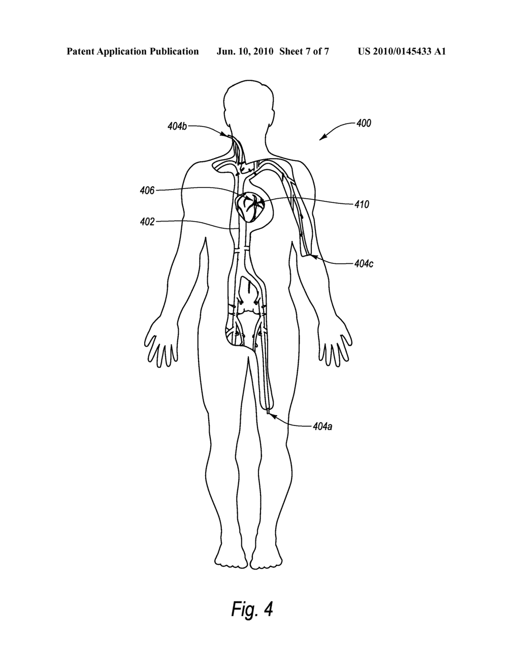 ENDOPROSTHESES FOR DEPLOYMENT IN A BODY LUMEN - diagram, schematic, and image 08