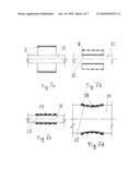 IMPLANTABLE PROSTHETIC VALVE STENT diagram and image