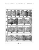 THERAPEUTIC AGENTS FOR ANGIOGENESIS-RELATED DISEASES COMPRISING CHONDROMODULIN-I AS ACTIVE INGREDIENT diagram and image