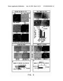 THERAPEUTIC AGENTS FOR ANGIOGENESIS-RELATED DISEASES COMPRISING CHONDROMODULIN-I AS ACTIVE INGREDIENT diagram and image