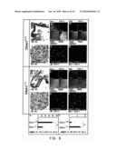 THERAPEUTIC AGENTS FOR ANGIOGENESIS-RELATED DISEASES COMPRISING CHONDROMODULIN-I AS ACTIVE INGREDIENT diagram and image