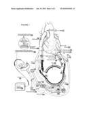 VENTRICULAR ASSIST DEVICE CAPABLE OF IMPLANTATION OF STEM CELLS diagram and image