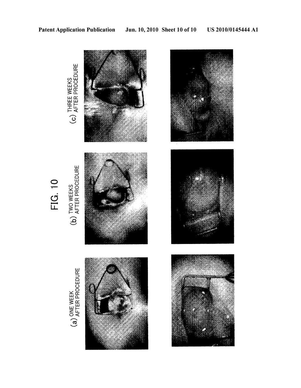 METHOD OF PREPARING DECELLULARIZED SOFT TISSUE, GRAFT AND CULTURE MATERIAL - diagram, schematic, and image 11