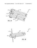 ADJUSTABLE ABSORBER DESIGNS FOR IMPLANTABLE DEVICE diagram and image