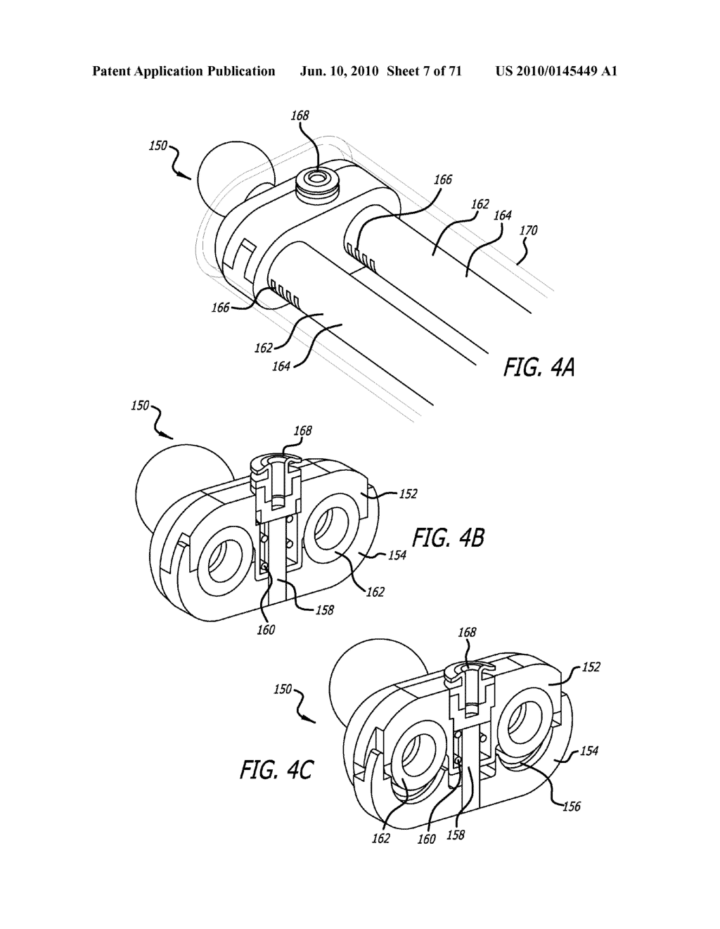 ADJUSTABLE ABSORBER DESIGNS FOR IMPLANTABLE DEVICE - diagram, schematic, and image 08