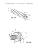 ADJUSTABLE ABSORBER DESIGNS FOR IMPLANTABLE DEVICE diagram and image