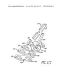 ADJUSTABLE ABSORBER DESIGNS FOR IMPLANTABLE DEVICE diagram and image