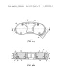 Lockable spinal implant diagram and image