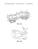 Lockable spinal implant diagram and image