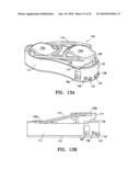 Lockable spinal implant diagram and image