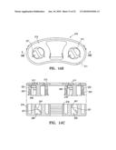 Lockable spinal implant diagram and image