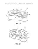 Lockable spinal implant diagram and image