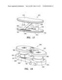 Lockable spinal implant diagram and image