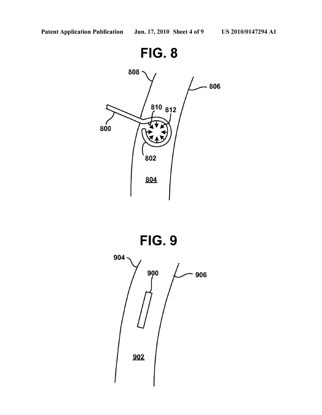 DEVICES AND METHODS TO MAINTAIN THE PATENCY OF AN OPENING RELATIVE TO PARENCHYMAL TISSUE OF THE LUNG - diagram, schematic, and image 05