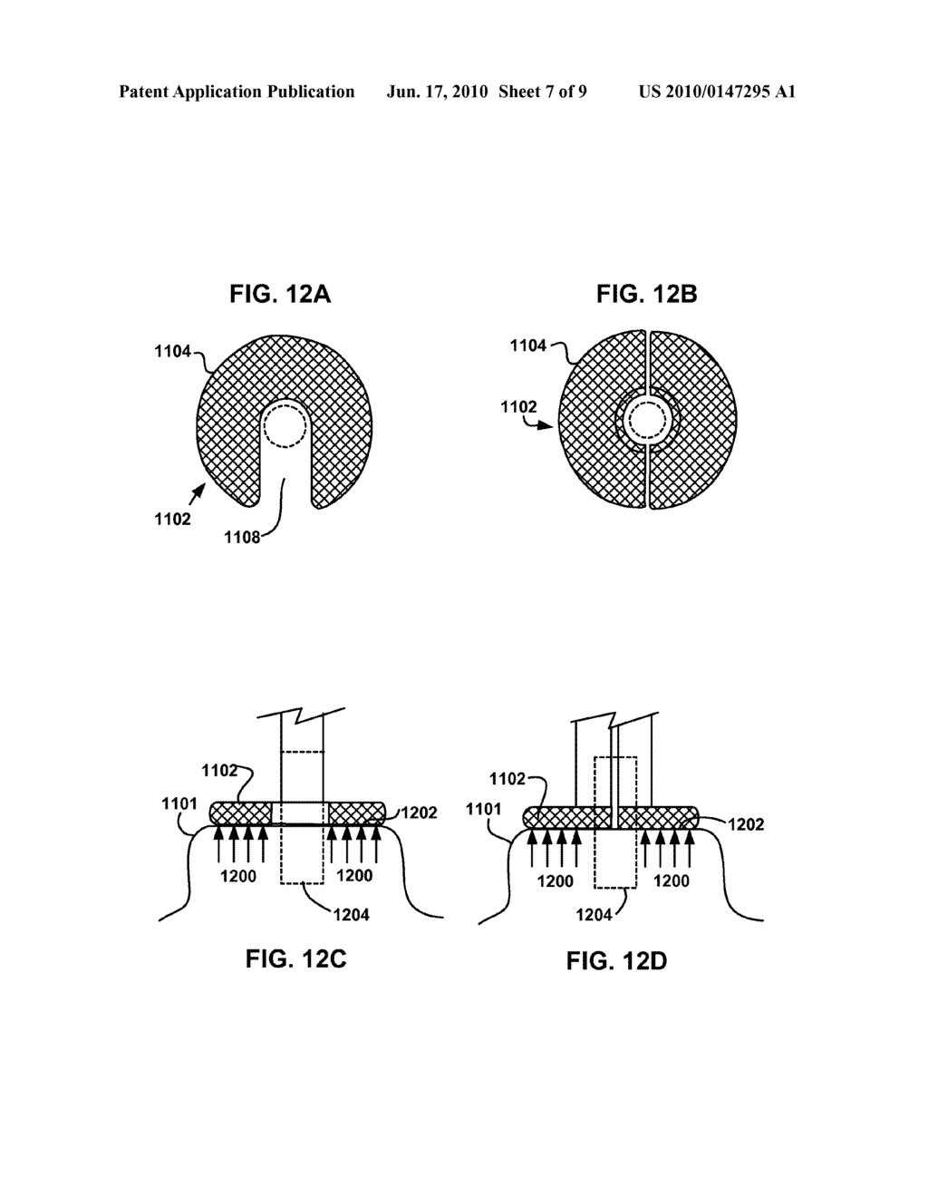 DEVICES AND METHODS TO CREATE AND MAINTAIN THE PATENCY OF AN OPENING RELATIVE TO PARENCHYMAL TISSUE OF THE LUNG - diagram, schematic, and image 08