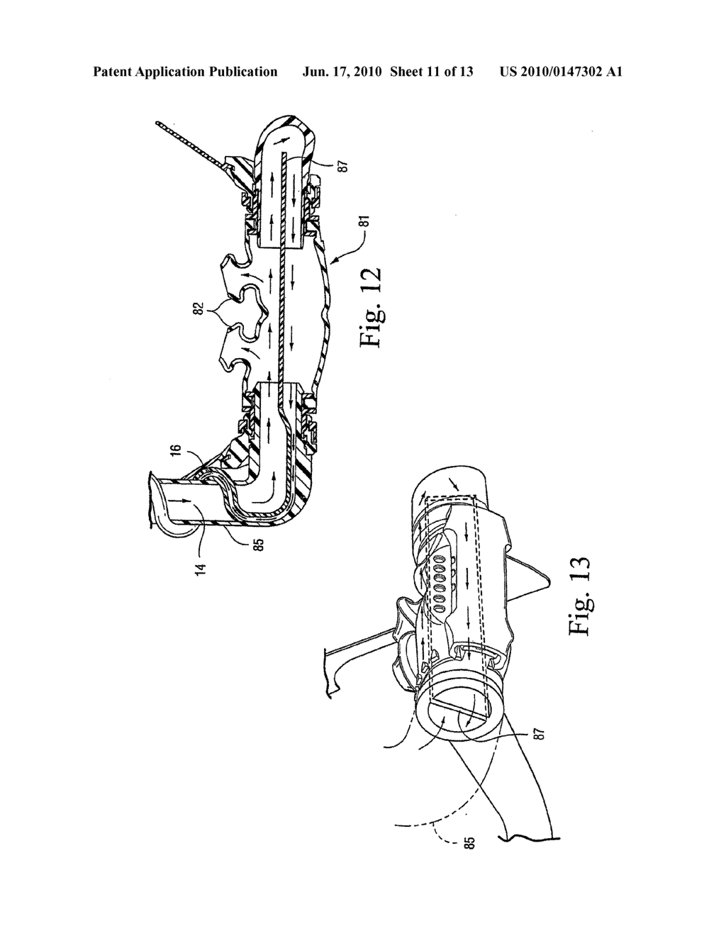 Ventless Mask CPAP System - diagram, schematic, and image 12