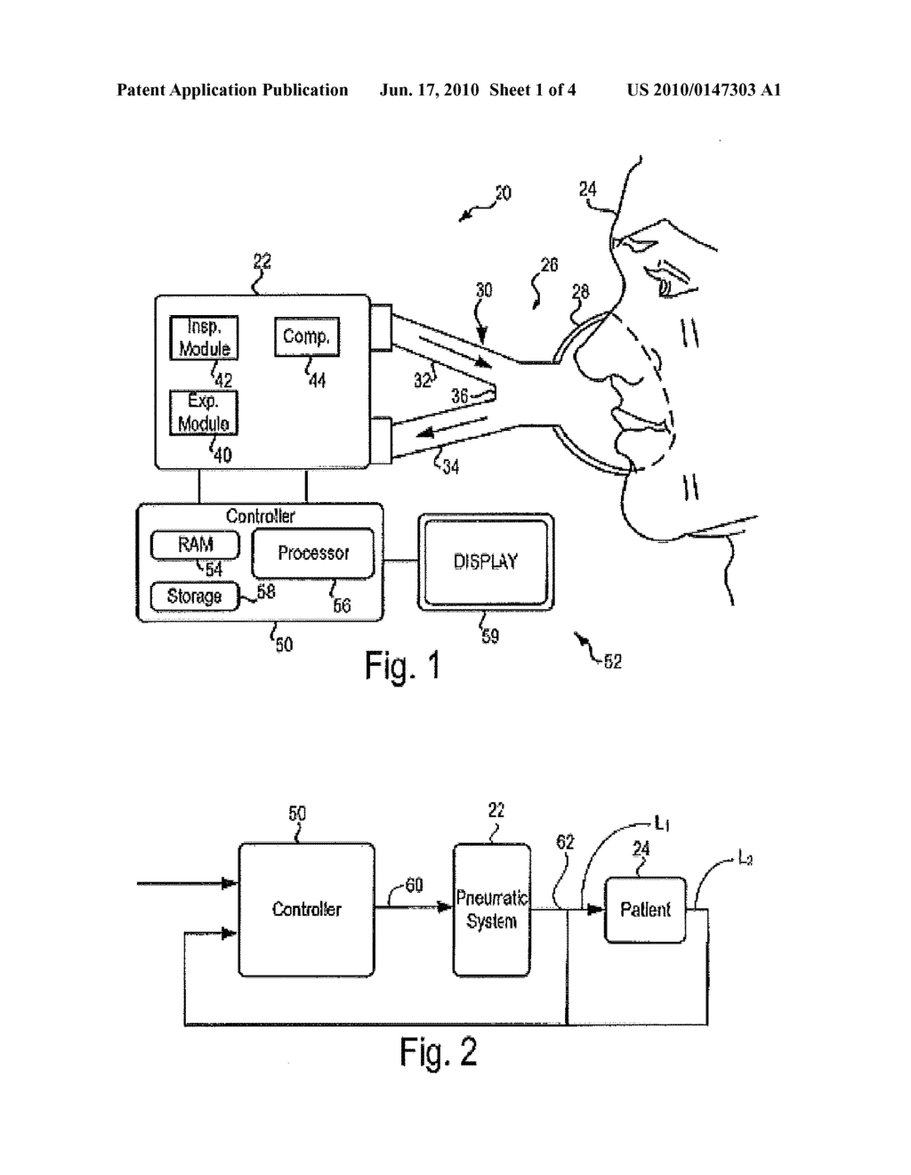 DETERMINATION OF PATIENT CIRCUIT DISCONNECT IN LEAK-COMPENSATED VENTILATORY SUPPORT - diagram, schematic, and image 02