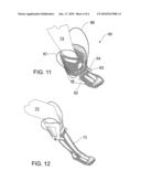 APPLICATOR FOR COMPRESSION STOCKINGS AND THE LIKE diagram and image