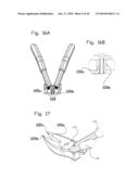 FASTENER EXTRACTION TOOL diagram and image