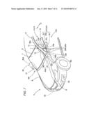 Air bag system diagram and image