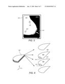 PROCESSING MEDICAL IMAGES OF THE BREAST TO DETECT ANATOMICAL ABNORMALITIES THEREIN diagram and image