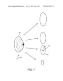 PROCESSING MEDICAL IMAGES OF THE BREAST TO DETECT ANATOMICAL ABNORMALITIES THEREIN diagram and image